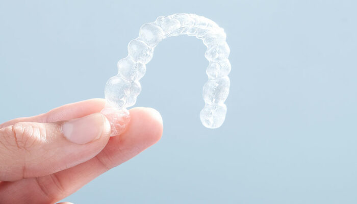 6 Benefits of Clear Aligners to Straighten Teeth